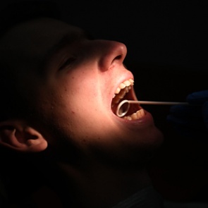 Стоматолог предупредил о смертельной опасности кариеса