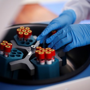 Российский врач назвал способ избежать тромбозов после коронавируса