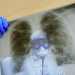 В Красноярском крае еще 18 человек умерли от коронавируса