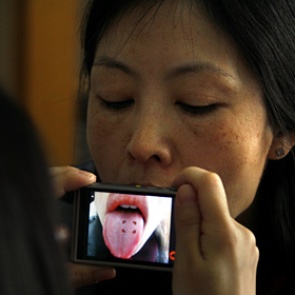 Врачи рассказали о смертельной опасности пятен на языке